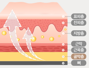 골막 고정